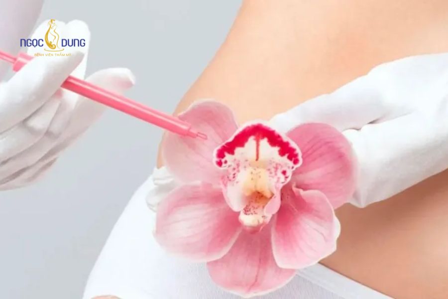 Cấy mỡ vùng bikini: Trẻ hóa toàn diện tại Ngọc Dung 7 Thao tác tiêm filler HA tổng hợp diễn ra nhanh chóng dưới 30 phút