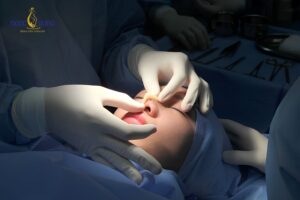 Thời điểm sửa mũi hỏng phụ thuộc vào nguyên nhân và mức độ tổn thương