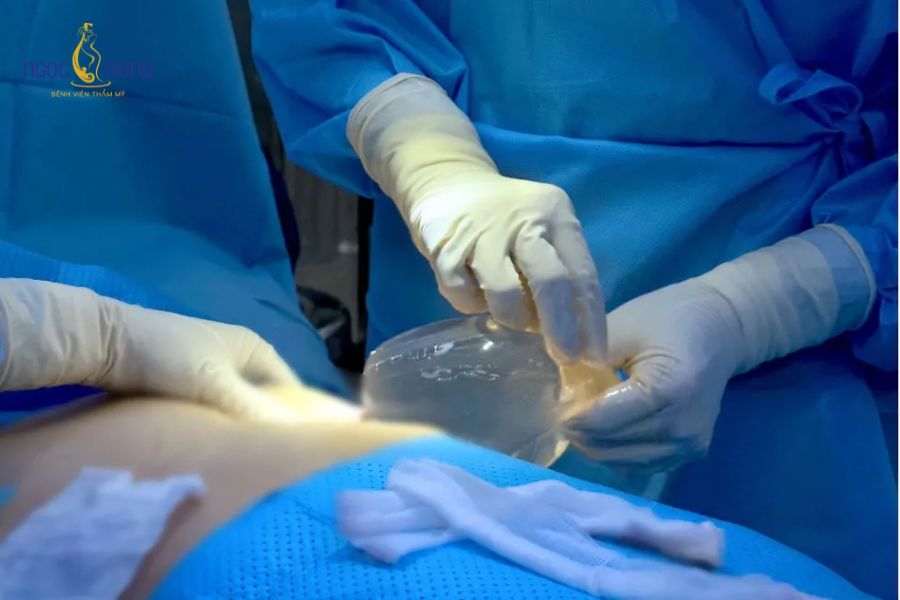 Nâng ngực bao lâu phải tháo ra? Dấu hiệu và cách xử lý 9 Thời điểm thay túi ngực phụ thuộc vào độ bền vật liệu, cơ địa và quá trình theo dõi sức khỏe định kỳ