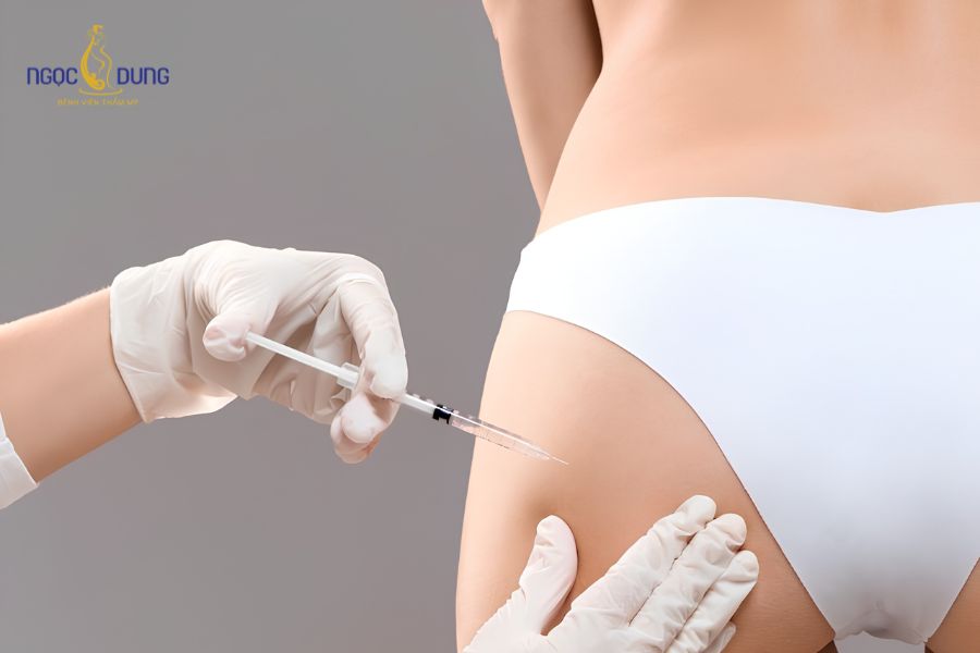 Nâng mông: Phương pháp phổ biến, bảng giá và an toàn 13 Tiêm chất làm đầy filler giúp làm mờ vùng hõm hai bên mông