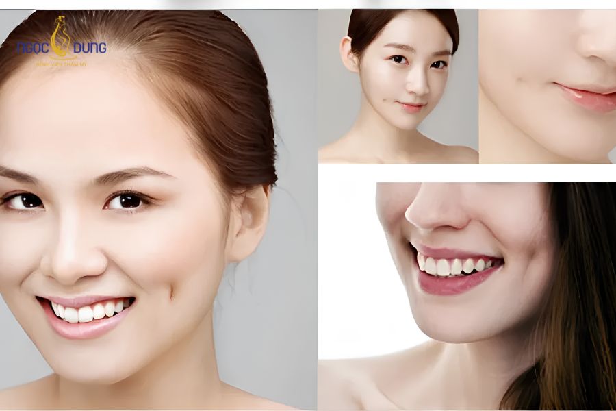 Cắt đồng tiền là gì? Giá bao nhiêu? Quy trình an toàn 8 Tư vấn chi phí và vị trí tạo lúm đồng tiền cân đối, phù hợp khuôn mặt