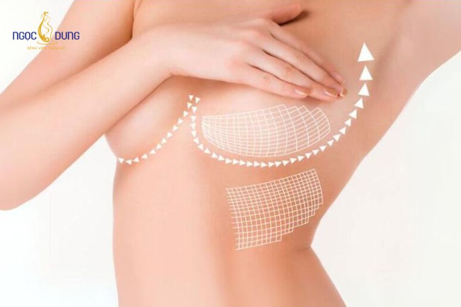 Các cách nâng ngực tại nhà tự nhiên, an toàn, hiệu quả 14 Tỷ lệ mô mỡ tích tụ tại bầu ngực phụ thuộc vào chỉ số BMI toàn thân