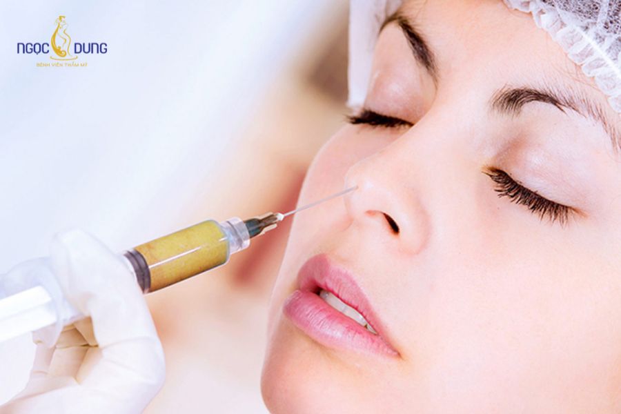 Cấy mỡ mặt vùng lẻ an toàn: Bảng giá và quy trình mới 12 Tỷ lệ tế bào mỡ sống sót sau khi cấy phụ thuộc nhiều vào cơ địa