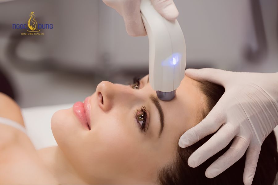 10 cách giảm nhăn cơ cau mày an toàn, lấy lại thanh xuân 9 Ứng dụng công nghệ cao xóa nhăn vùng trán