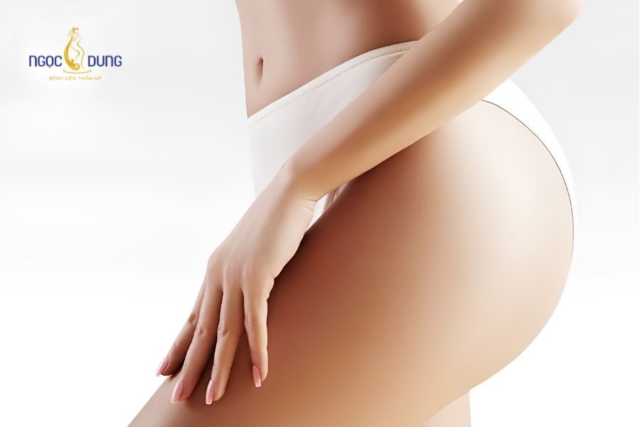 Hút mỡ mông là gì? Giá bao nhiêu? Quy trình an toàn 11 Vóc dáng thắt eo nở hậu hiện rõ đường nét đồng hồ cát sau mổ