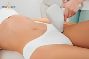 Vùng bikini trở nên đầy đặn, săn mịn tự nhiên sau khi ổn định cấu trúc