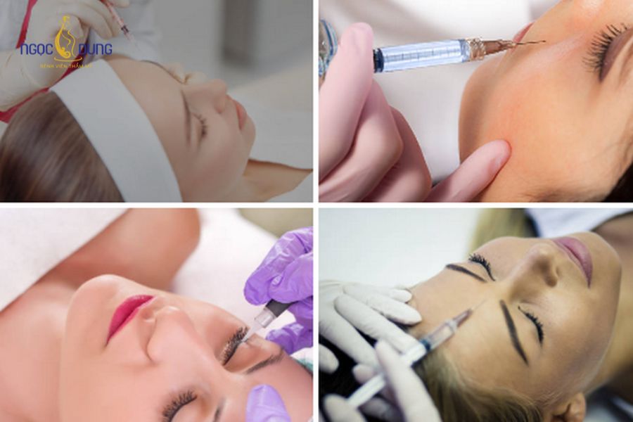 Tiêm filler có an toàn không? Tác dụng phụ cần biết 10 Axit Hyaluronic tự phân hủy theo thời gian mà không để lại tác động xấu lâu dài cho da