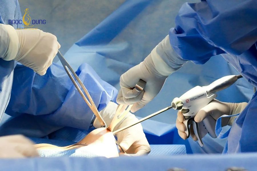 Nâng ngực có bị mất cảm giác không? Giải đáp từ chuyên gia 13 Bác sĩ chuyên khoa thao tác chính xác, bảo tồn hệ thần kinh vùng ngực trong phòng mổ vô trùng
