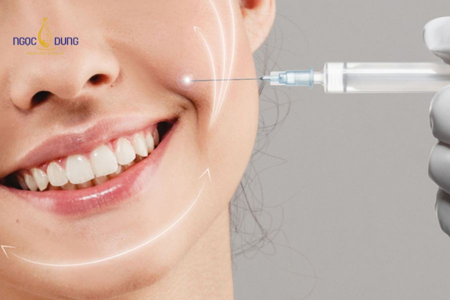 Giá tiêm filler rãnh cười bao nhiêu? Bảng giá mới nhất 10 Bác sĩ đo vẽ và xác định chính xác liều lượng cc filler cần bổ sung để làm đầy rãnh cười tự nhiên