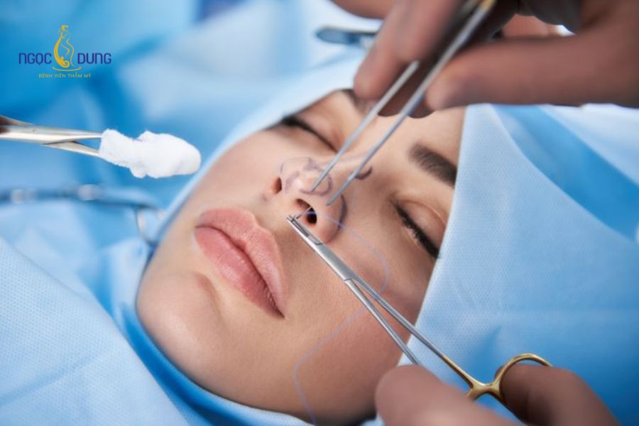 Tiêm filler mũi bị lệch: Nguyên nhân và cách khắc phục 11 Bác sĩ tiến hành kiểm tra lâm sàng để đánh giá mức độ lệch và tình trạng mô mềm xung quanh