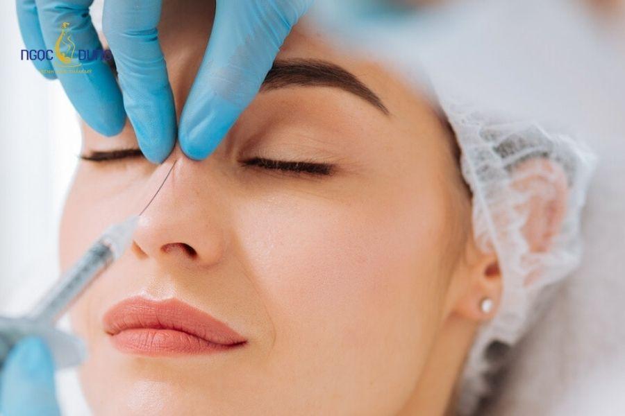 Tiêm filler rồi có nâng mũi được không? Cần lưu ý gì? 11 Bác sĩ tiến hành tiêm tan chất làm đầy cũ trước khi can thiệp phẫu thuật đặt sụn mới