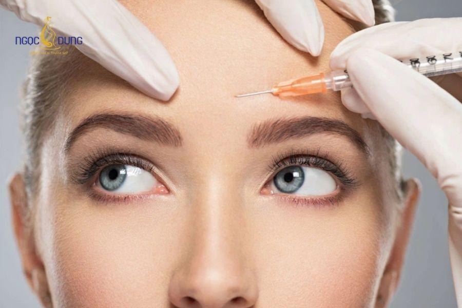 Tiêm filler trán: Giải pháp làm đầy an toàn, hiệu quả 11 Bổ sung thể tích vùng trán và ấn đường trũng hụt giúp ngũ quan cân đối tự nhiên