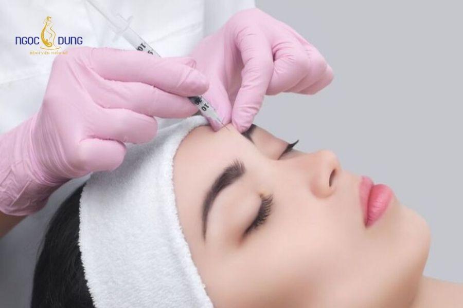 Tiêm filler trán: Giải pháp làm đầy an toàn, hiệu quả 10 Các biến chứng sưng bầm hoặc vón cục do kỹ thuật tiêm không đúng lớp mô