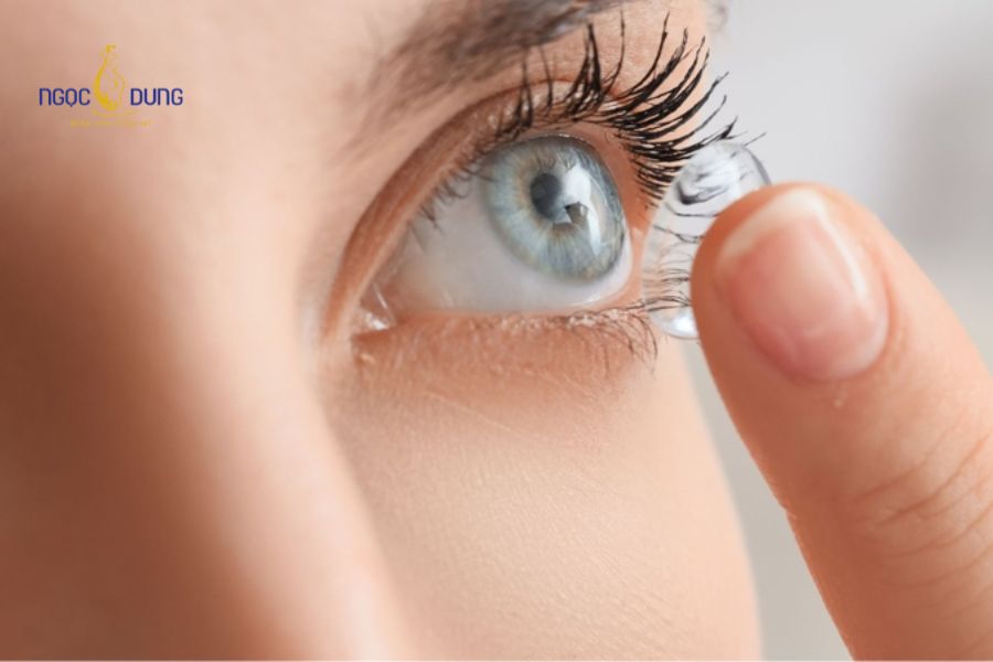Tiêm filler mũi có đeo kính được không? Cần lưu ý gì? 12 Các giải pháp thay thế như kính áp tròng hoặc gọng siêu nhẹ hỗ trợ người có tật khúc xạ nhìn rõ mà vẫn bảo vệ dáng mũi