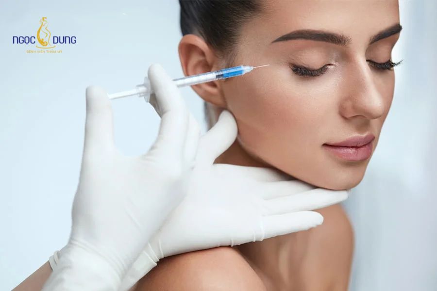 Mù mắt sau tiêm filler: Nguyên nhân và cách xử lý gấp 13 Can thiệp tiêm tan filler bằng enzym hyaluronidase trong "thời gian vàng" giúp giải phóng lòng mạch bị tắc