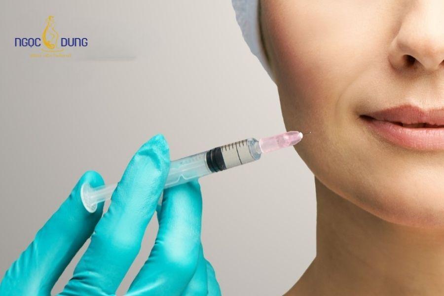 Tiêm filler rãnh cười: Hiệu quả, bảng giá, duy trì 22 Chăm sóc hậu phẫu đúng cách hỗ trợ vùng tiêm mau thuyên giảm sưng bầm