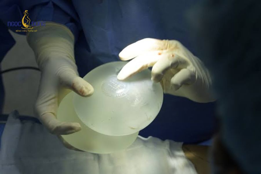 Tại sao nâng ngực bị bao xơ? Dấu hiệu và cách khắc phục 16 Co thắt bao xơ có thể xuất hiện bất cứ lúc nào sau khi túi ngực đã ổn định trong khoang ngực