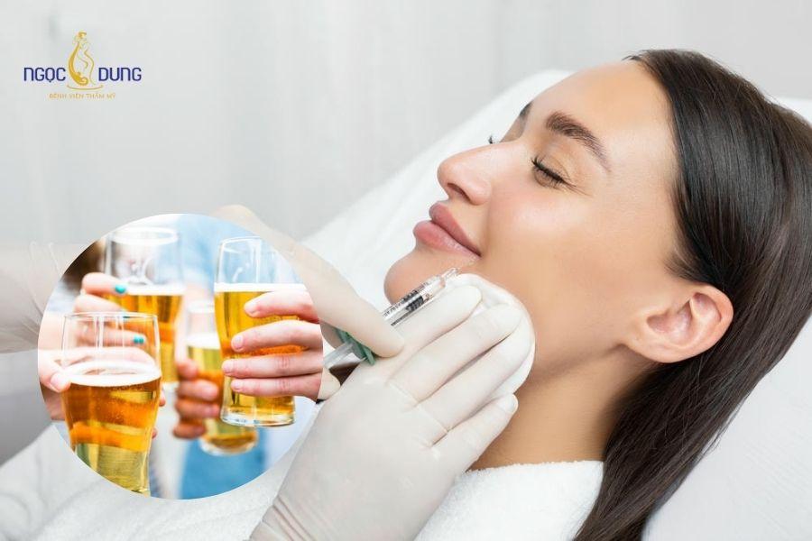 Tiêm filler uống bia có sao không? Cần kiêng bao lâu? 8 Cồn trong bia rượu làm giãn mạch máu, dễ gây sưng bầm và làm chậm quá trình phục hồi của vùng da vừa tiêm filler