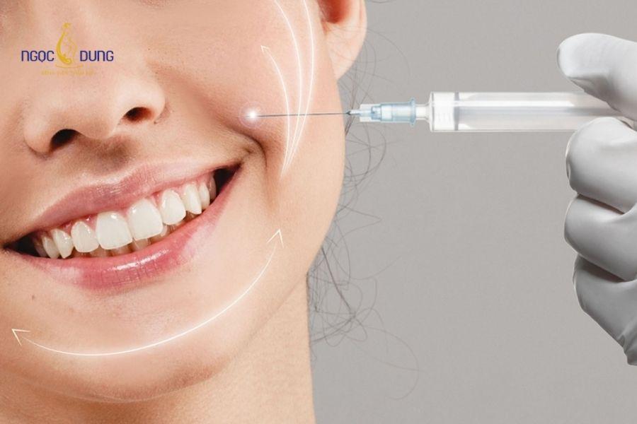Tiêm filler rãnh cười: Hiệu quả, bảng giá, duy trì 18 Định lượng cc chất làm đầy cho rãnh cười được bác sĩ đo vẽ chính xác cho từng khách hàng