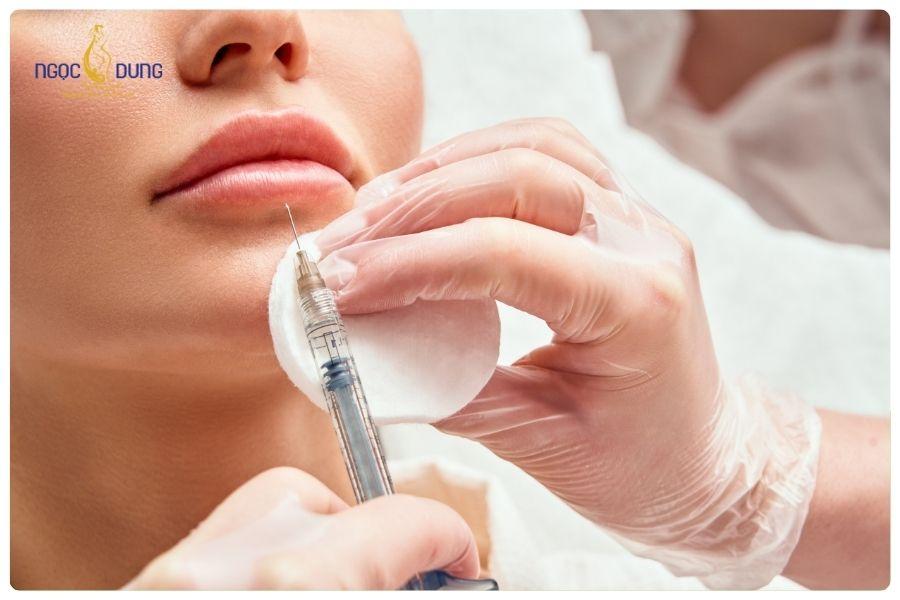 Tiêm filler giá bao nhiêu? Bảng giá cập nhật mới nhất 19 Giá tiêm filler sẽ thay đổi tùy vào vị trí tiêm, loại filler và lượng filler sử dụng