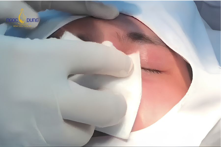 Mù mắt sau tiêm filler: Nguyên nhân và cách xử lý gấp 10 Hệ thống mạch máu phức tạp vùng mặt giữa thông nối trực tiếp với động mạch mắt