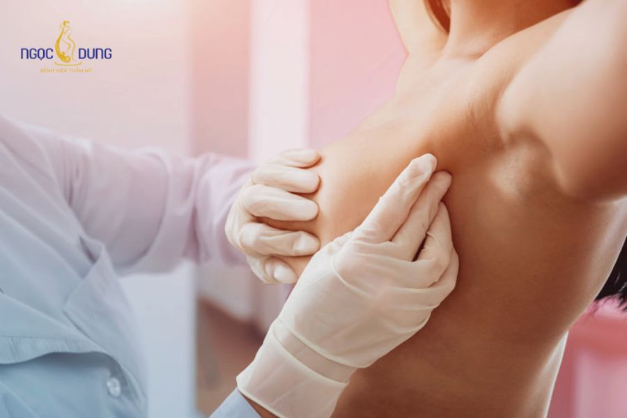 Nâng ngực bị nhiễm trùng: Dấu hiệu và cách xử lý an toàn 14 Khám bác sĩ ngay khi ngực có biểu hiện biến dạng hoặc sưng đau nghiêm trọng