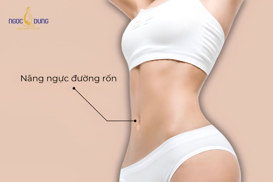 Phẫu thuật nâng ngực đường nào tốt và an toàn nhất? 13 Kỹ thuật nâng ngực qua đường rốn ít phổ biến trong phẫu thuật tạo hình thẩm mỹ