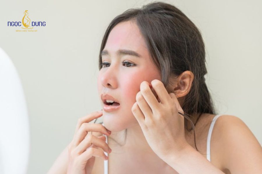 Dấu hiệu tiêm filler bị hoại tử và cách xử lý an toàn 8 Làn da chuyển sang màu tái nhợt hoặc tím vằn lưới do thiếu máu nuôi dưỡng