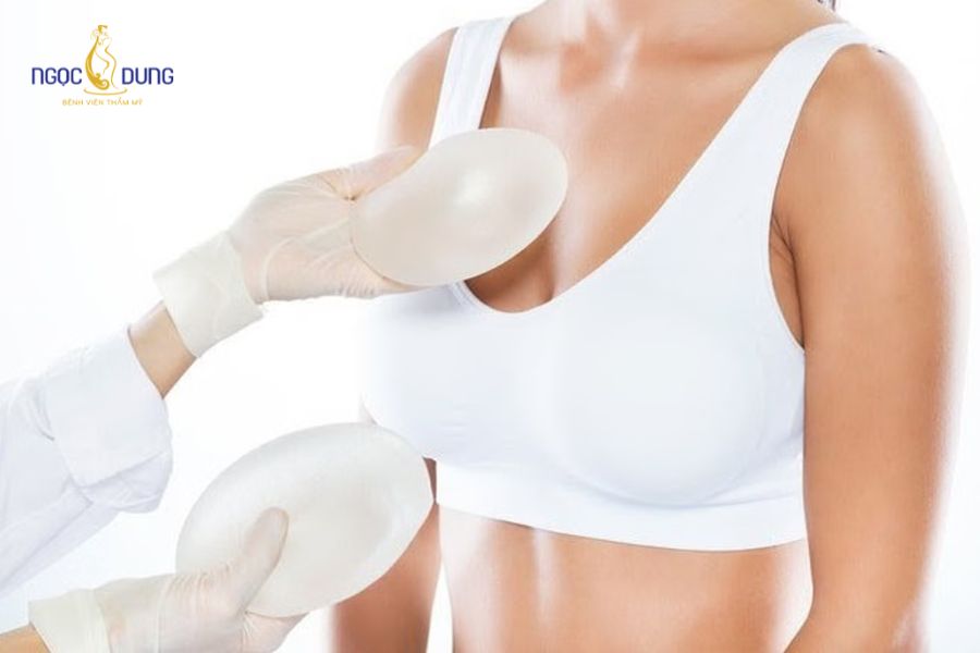 Nâng ngực size 250 dành cho ai? Cách đo size chuẩn xác 17 Nắm rõ những nguyên tắc quan trọng cần tuân thủ khi chuẩn bị phẫu thuật nâng ngực 250cc rất quan trọng