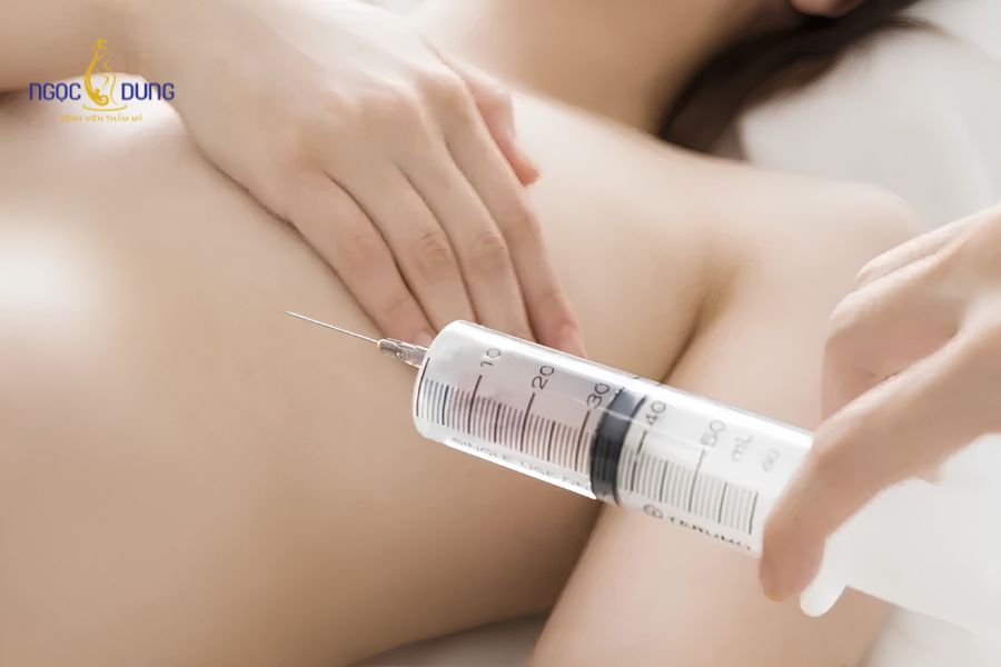 Nâng ngực không phẫu thuật là gì? Phương pháp và đánh giá 11 Nâng ngực không phẫu thuật là cách gọi chung cho các phương pháp giúp vòng 1 đầy đặn hơn mà không cần phẫu thuật đặt túi độn ngực