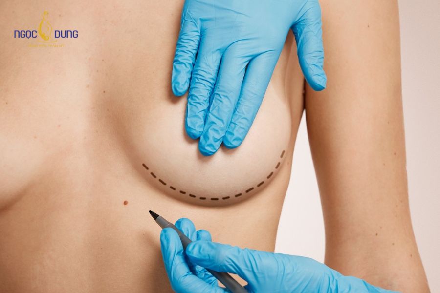 Nâng ngực có sinh con được không? Giải đáp từ Ngọc Dung 13 Nâng ngực sau khi đã hoàn thành sinh nở giúp duy trì form ngực bền vững và ổn định lâu dài