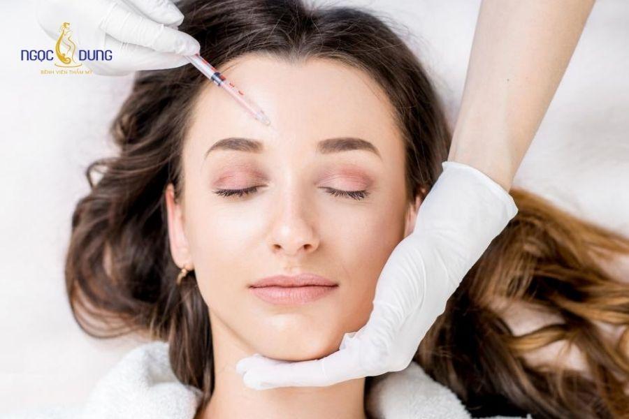 Tiêm filler trán: Giải pháp làm đầy an toàn, hiệu quả 12 Quy trình tiêm filler trán diễn ra trong khoảng 20-30 phút không mất thời gian nghỉ dưỡng dài