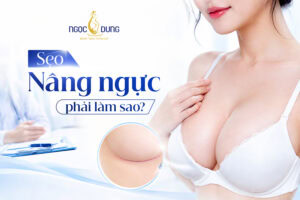 Sẹo nâng ngực: Nguyên nhân, phân loại và cách giảm thiểu