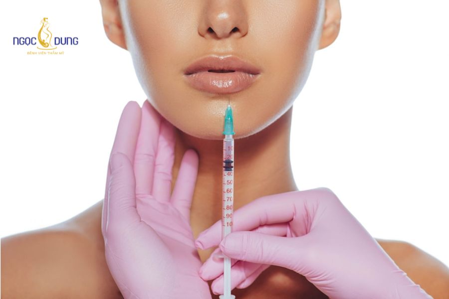 Tiêm filler môi bao lâu thì tan? Cách chăm sóc an toàn 10 Sử dụng filler HA chính hãng có liên kết chéo bền vững giúp duy trì phom dáng môi kéo dài