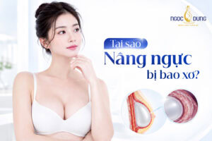tai sao nang nguc bi bao xo