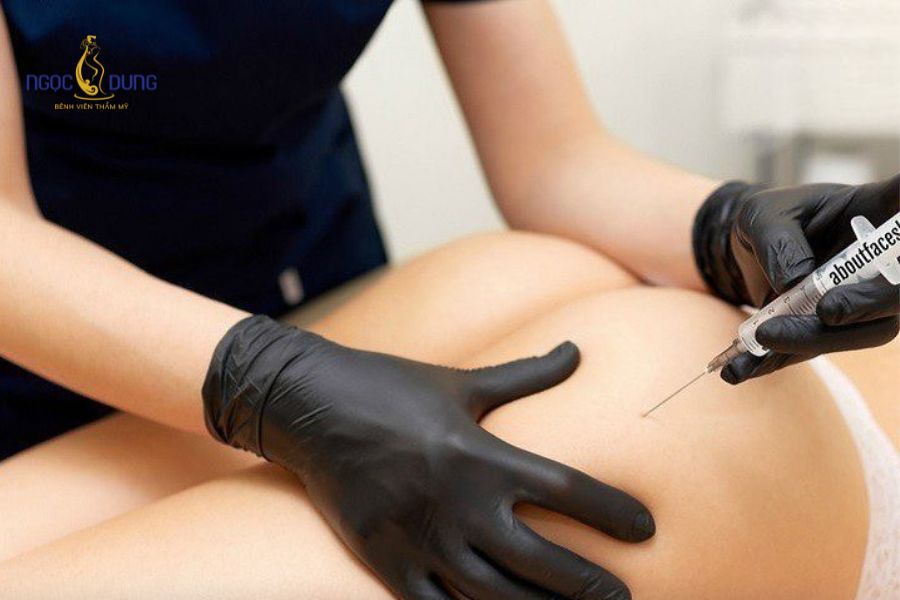 Tiêm filler mông là gì? Có an toàn không? Điều cần biết 18 Thăm khám và chẩn đoán hình ảnh siêu âm hỗ trợ bác sĩ xây dựng phác đồ xử lý biến chứng y khoa