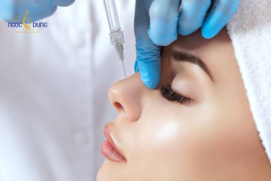 Tiêm filler mũi bị lệch: Nguyên nhân và cách khắc phục 8 Thao tác tiêm sai lớp mô của người thực hiện thiếu chuyên môn làm filler phân bố không đều