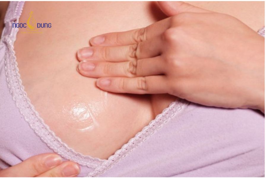 Nâng ngực có cho con bú được không? Giải đáp chi tiết 16 Theo dõi các dấu hiệu bất thường trên bầu ngực để xử lý sớm nguy cơ tắc tuyến sữa