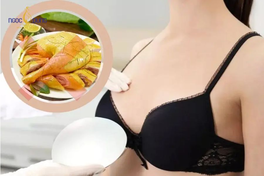 Nâng ngực có được ăn thịt gà không? Nên kiêng bao lâu? 13 Thời gian kiêng thịt gà sau phẫu thuật nâng ngực kéo dài từ 4 đến 6 tuần tùy cơ địa
