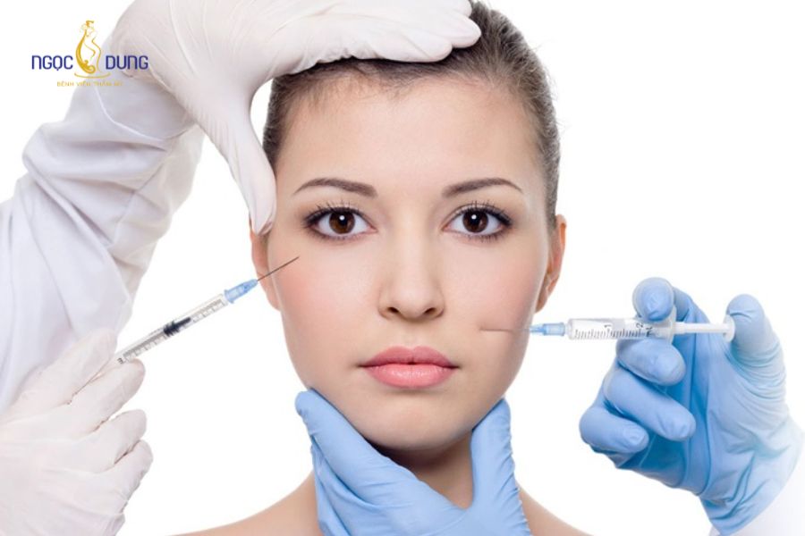 Tiêm filler má baby: Bảng giá và thời gian duy trì 17 Thủ thuật tiêm filler an toàn khi được thực hiện đúng lớp giải phẫu bởi bác sĩ chuyên khoa
