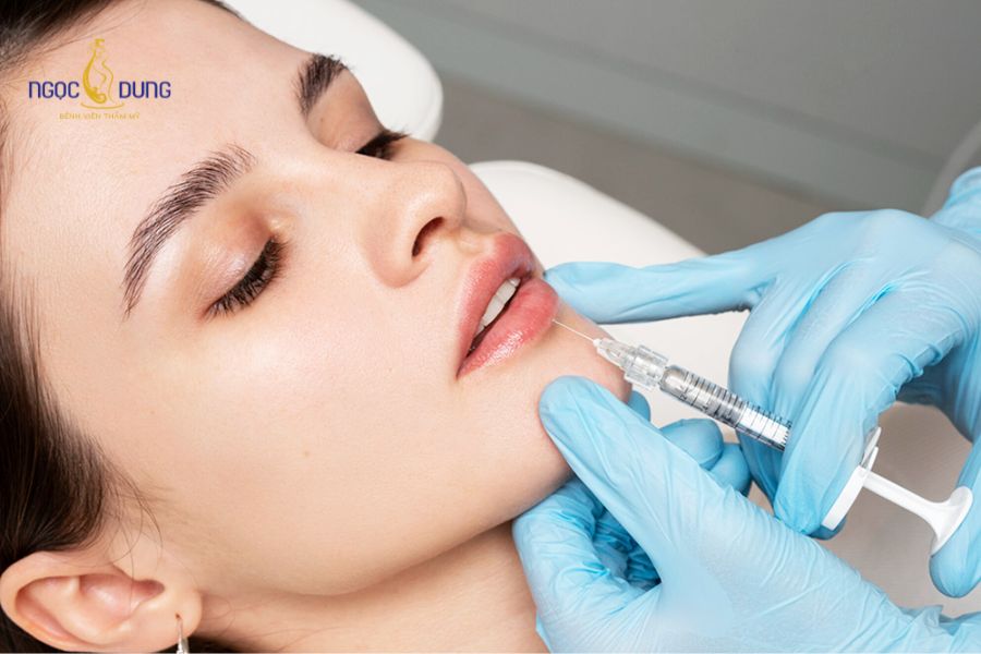 Môi dày có tiêm filler được không? Dáng môi hài hòa, được ưa chuộng 10 Tiêm filler giúp cân chỉnh tỷ lệ môi trên - môi dưới và làm rõ đường viền cho người có dáng môi dày