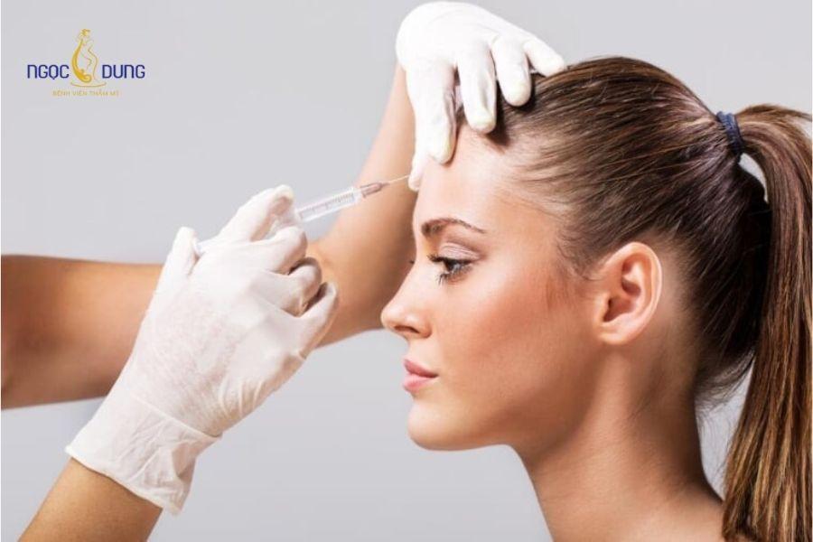 Tiêm filler trán: Giải pháp làm đầy an toàn, hiệu quả 14 Tiêm filler làm đầy trán phù hợp với người muốn cải thiện diện mạo không qua phẫu thuật