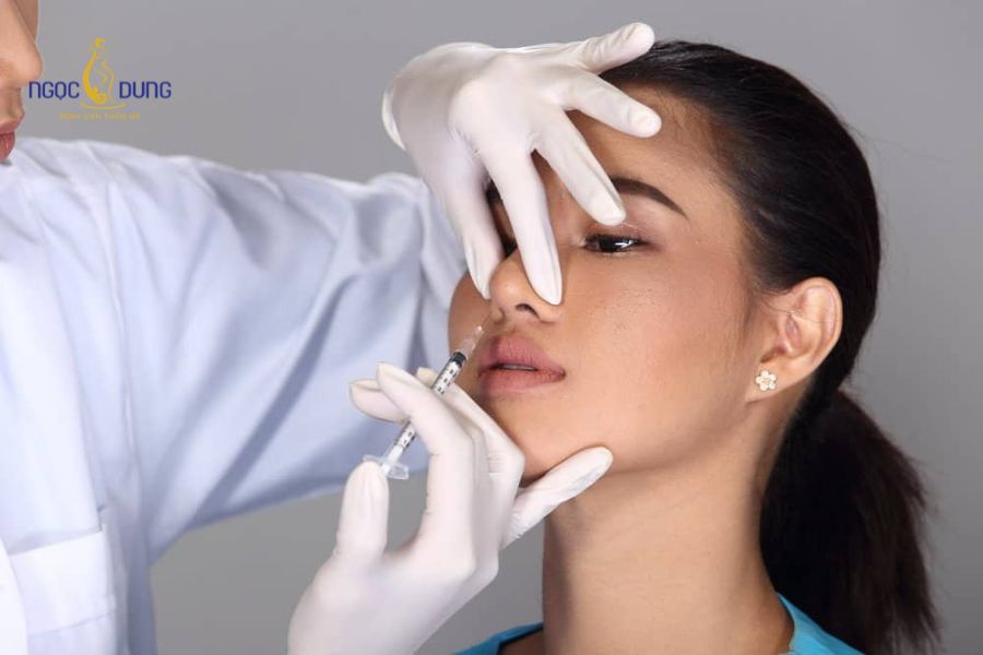 Giá tiêm filler mũi bao nhiêu? Bảng giá cập nhật mới 16 Tiêm filler mũi có thời gian thực hiện nhanh chóng, không mất thời gian nghỉ dưỡng