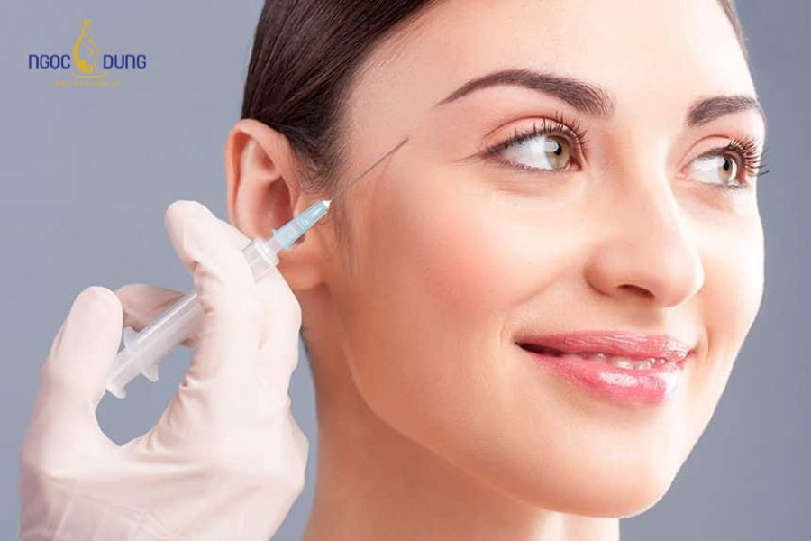 Tiêm filler thái dương: Tác dụng, quy trình và bảng giá 12 Tiêm filler thái dương giúp gương mặt trẻ trung hơn
