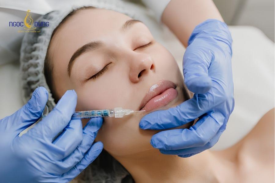 Tiêm filler rãnh cười: Hiệu quả, bảng giá, duy trì 20 Tiêm sai kỹ thuật hoặc sử dụng loại filler không phù hợp có thể gây hiện tượng đơ cứng