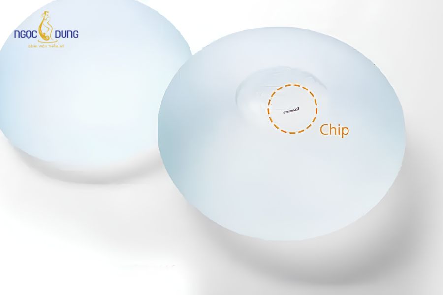 Nâng ngực size 250 dành cho ai? Cách đo size chuẩn xác 15 Túi ngực Nano Chip cao cấp tích hợp vi mạch thông minh hỗ trợ truy xuất dữ liệu y khoa