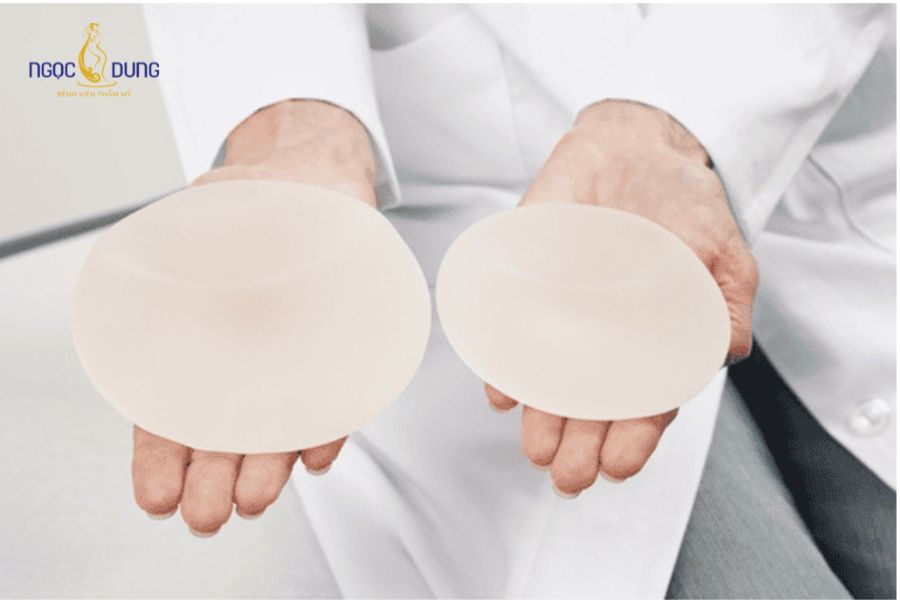 Nâng ngực giọt nước: Giải pháp vòng 1 căng tròn tự nhiên 16 Túi tròn phân bổ thể tích đều khắp bầu ngực, giúp phần ngực trên đầy đặn rõ rệt