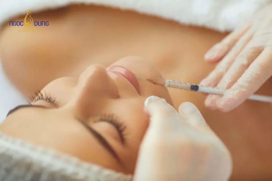 Tiêm filler là gì? Bảng giá và dịch vụ tiêm filler an toàn 13 Vùng tiêm filler sẽ dần gom form và đẹp tự nhiên từ 1 đến 2 tuần sau thủ thuật