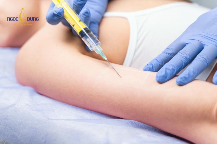 Có nên hút mỡ bắp tay không? Giải đáp chi tiết, đầy đủ 15 Các phương pháp thẩm mỹ nội khoa không xâm lấn thích hợp với khách hàng có lượng mỡ thừa ít