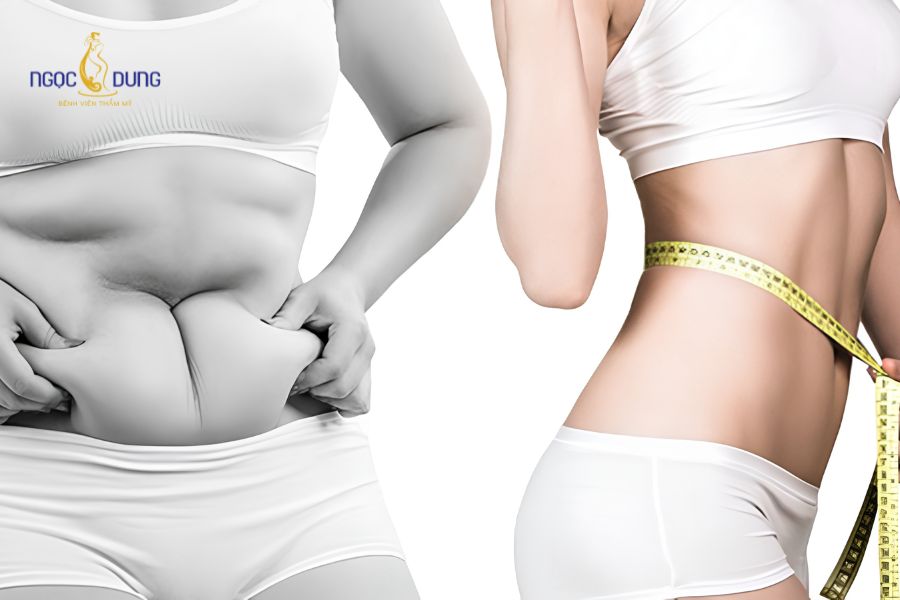 Hút mỡ bao nhiêu tiền? Bảng giá cập nhật mới nhất 2026 9 Chi phí hút mỡ được tính dựa trên phân vùng thực hiện, diện tích và khối lượng mỡ thừa của từng khách hàng
